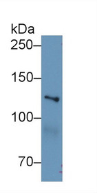 Western Blot; Sample: Human Hela cell lysate; Primary Ab: 1µg/ml Rabbit Anti-Mouse MYO1E Antibody Second Ab: 0.2µg/mL HRP-Linked Caprine Anti-Rabbit IgG Polyclonal Antibody