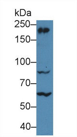 Western Blot; Sample: Mouse Cerebrum lysate; Primary Ab: 5µg/ml Rabbit Anti-Human MYH10 Antibody Second Ab: 0.2µg/mL HRP-Linked Caprine Anti-Rabbit IgG Polyclonal Antibody