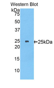 Western Blot; Sample: Recombinant protein.