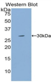 Western Blot; Sample: Recombinant protein.