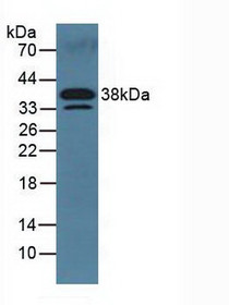 Western Blot; Sample: Mouse Serum.