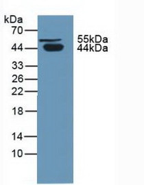 Western Blot; Sample: Human Urine.