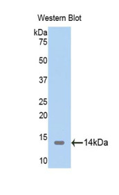 Western Blot; Sample: Recombinant protein.