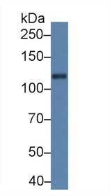 Western Blot; Sample: Rat Cerebrum lysate; Primary Ab: 5µg/ml Rabbit Anti-Rat Slit1 Antibody Second Ab: 0.2µg/mL HRP-Linked Caprine Anti-Rabbit IgG Polyclonal Antibody