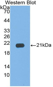 Western Blot; Sample: Recombinant protein.