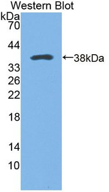 Western Blot; Sample: Recombinant protein.