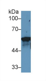 Western Blot; Sample: Human MCF7 cell lysate; Primary Ab: 1µg/ml Rabbit Anti-Rat KRT6A Antibody Second Ab: 0.2µg/mL HRP-Linked Caprine Anti-Rabbit IgG Polyclonal Antibody