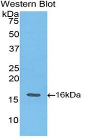 Western Blot; Sample: Recombinant protein.