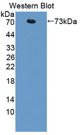 Western Blot; Sample: Recombinant protein.