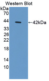 Western Blot; Sample: Recombinant protein.