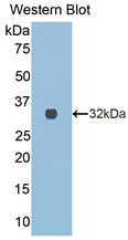 Western Blot; Sample: Recombinant protein.