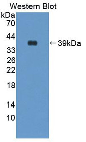 Western Blot; Sample: Recombinant protein.
