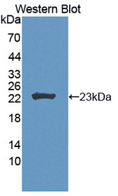 Western Blot; Sample: Recombinant protein.