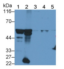 Western Blot; Sample: Recombinant protein.