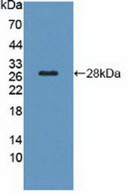 Western Blot; Sample: Recombinant TSHR, Rat.