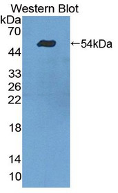 Western Blot; Sample: Recombinant protein.
