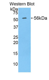 Western Blot; Sample: Recombinant protein.