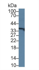 Western Blot; Sample: Human Lung lysate; Primary Ab: 1µg/ml Rabbit Anti-Human RGN Antibody Second Ab: 0.2µg/mL HRP-Linked Caprine Anti-Rabbit IgG Polyclonal Antibody
