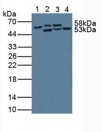 Western Blot; Sample: Lane1: Human Serum; Lane2: Human Liver Tissue; Lane3: Porcine Kidney Tissue; Lane4: Mouse Gallbladder Tissue.