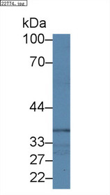 Western Blot; Sample: Human Lung lysate; Primary Ab: 1µg/ml Rabbit Anti-Human NCK1 Antibody Second Ab: 0.2µg/mL HRP-Linked Caprine Anti-Rabbit IgG Polyclonal Antibody