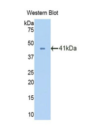 Western Blot; Sample: Recombinant protein.