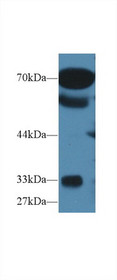 Western Blot; Sample: Human Serum; Primary Ab: 1µg/ml Rabbit Anti-Human OS9 Antibody Second Ab: 0.2µg/mL HRP-Linked Caprine Anti-Rabbit IgG Polyclonal Antibody