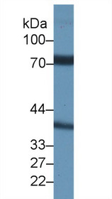 Western Blot; Sample: Rat Testis lysate; Primary Ab: 1µg/ml Rabbit Anti-Rat NCSTN Antibody Second Ab: 0.2µg/mL HRP-Linked Caprine Anti-Rabbit IgG Polyclonal Antibody