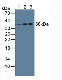 Western Blot; Lane1: Mouse Liver Tissue; Lane2: Human Jurkat Cells; Lane3: Human K562 Cells.