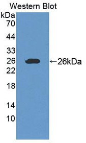 Western Blot; Sample: Recombinant protein.