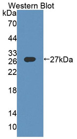 Western Blot; Sample: Recombinant protein.