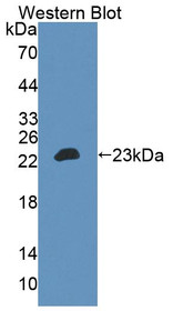 Western Blot; Sample: Recombinant protein.