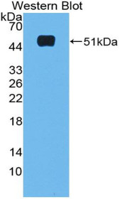 Western Blot; Sample: Recombinant protein.