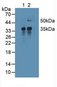 Western Blot; Lane1: Mouse Liver Tissue; Lane2: Mouse Spleen Tissue.