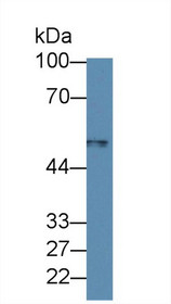 Western Blot; Sample: Human Leukocyte lysate; Primary Ab: 1µg/ml Rabbit Anti-Rat MARCO Antibody Second Ab: 0.2µg/mL HRP-Linked Caprine Anti-Rabbit IgG Polyclonal Antibody