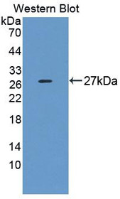 Western Blot; Sample: Recombinant protein.