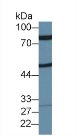 Western Blot; Sample: Rat Placenta lysate; Primary Ab: 1µg/ml Rabbit Anti-Rat ZP2 Antibody Second Ab: 0.2µg/mL HRP-Linked Caprine Anti-Rabbit IgG Polyclonal Antibody