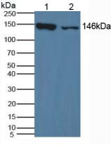 Western Blot; Sample: Lane1: Mouse Liver Tissue; Lane2: Mouse Lung Tissue.