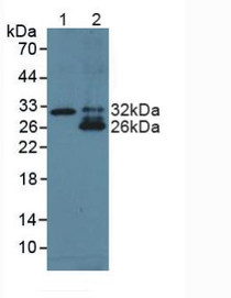 Western Blot; Sample: Lane1: Human Liver Tissue; Lane2: Human Lung Tissue.