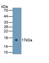 Uroplakin 1A (UPK1A) Polyclonal Antibody, CAU24083