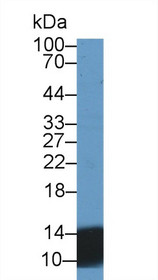 Western Blot; Sample: Human Urine; Primary Ab: 2µg/ml Rabbit Anti-Human UCN2 Antibody Second Ab: 0.2µg/mL HRP-Linked Caprine Anti-Rabbit IgG Polyclonal Antibody