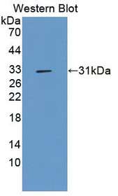 Western Blot; Sample: Recombinant protein.