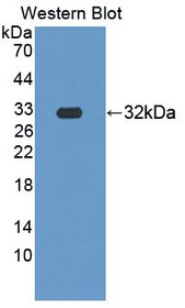 Western Blot; Sample: Recombinant protein.