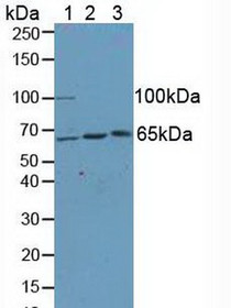Western Blot; Sample: Lane1: Human Hela Cells; Lane2: Rat Brain Tissue; Lane3: Rat Spinal Cord Tissue.