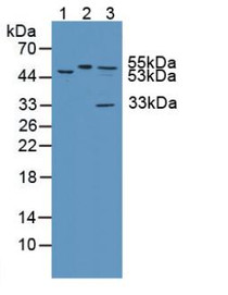 Western Blot; Sample: Lane1: Mouse Brain Tissue; Lane2: Mouse Spleen Tissue; Lane3: Human Hela Cells.