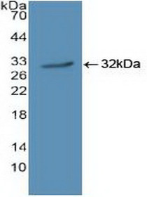 Western Blot; Sample: Recombinant JAK1, Human.