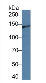 Western Blot; Sample: Mouse Gallbladder lysate; Primary Ab: 1µg/ml Rabbit Anti-Rat ITSN1 Antibody Second Ab: 0.2µg/mL HRP-Linked Caprine Anti-Rabbit IgG Polyclonal Antibody