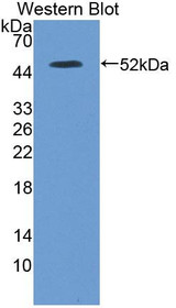 Western Blot; Sample: Recombinant protein.