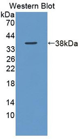 Western Blot; Sample: Recombinant protein.