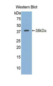 Western Blot; Sample: Recombinant protein.