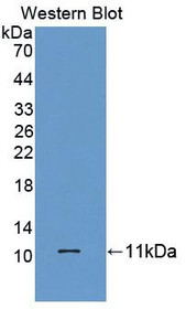 Western Blot; Sample: Recombinant protein.